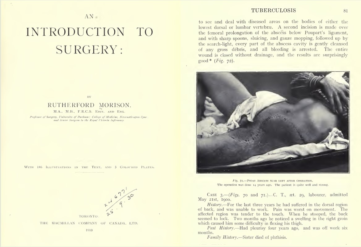 Pages from JR Morison’s An Introduction to Surgery
